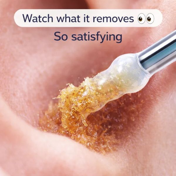 Cleaning Sticks – Gentle, Visible Ear Care