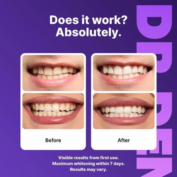 🦷7D Wisdom Tooth Whitening – Gentle, Effective Dental Care With Sea Salt for Bright White Teeth 💎