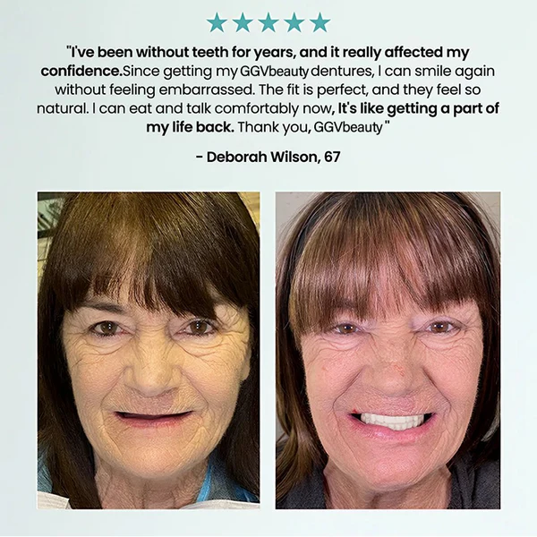 🦷 Fit Full Functional Dentures Make you more confident