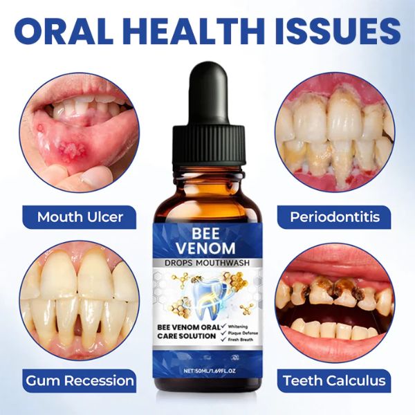 Bee Venom Oral Care Solution
